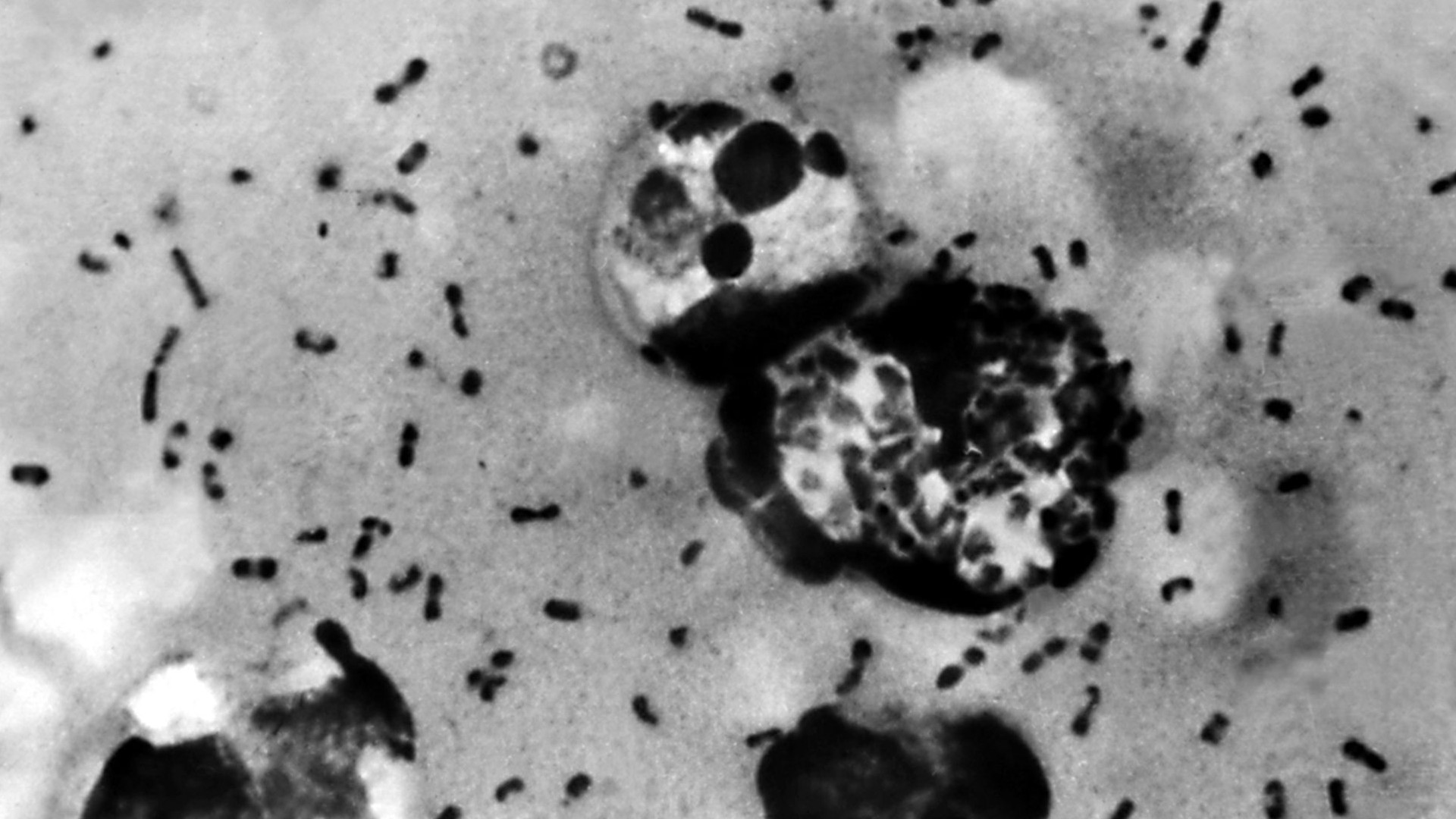Scientists Found the Oldest Strain of Black Death bacteria in 5,000-Year-Old Human Remains!